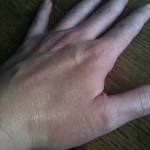 IMG_0789 My mottled paw wearing Superdrug BB cream swatch