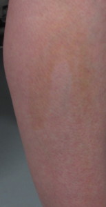 Leg before Bronze Buffer
