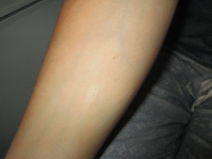 Arm after using Bronze Buffer